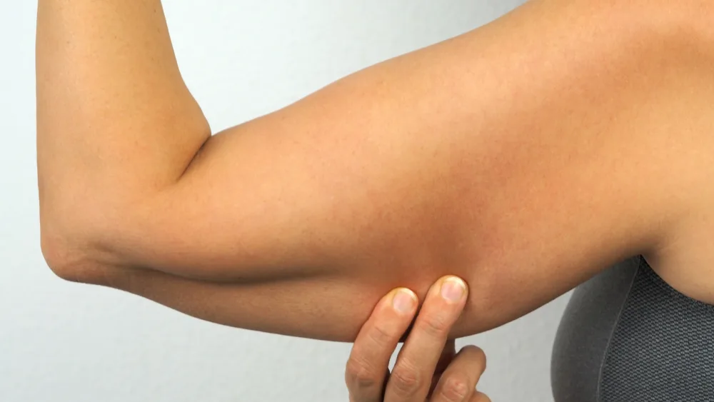 Upper Arms